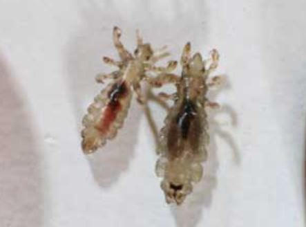 Headlice