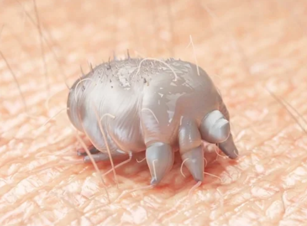 Scabies Mite